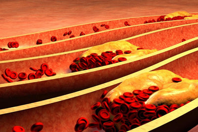 8 Ways to Lower Your Cholesterol Naturally