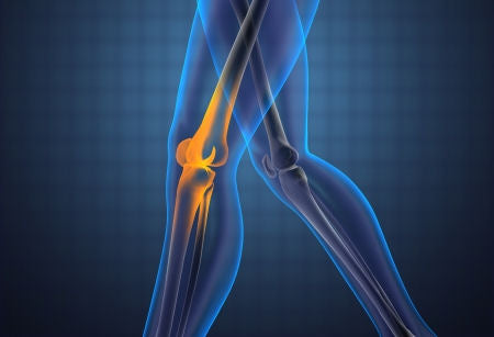 Arthritis? The Right Diet Can Help