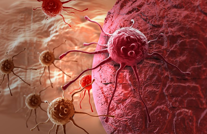 What Causes Cancer? These 9 Things May Increase Your Risk
